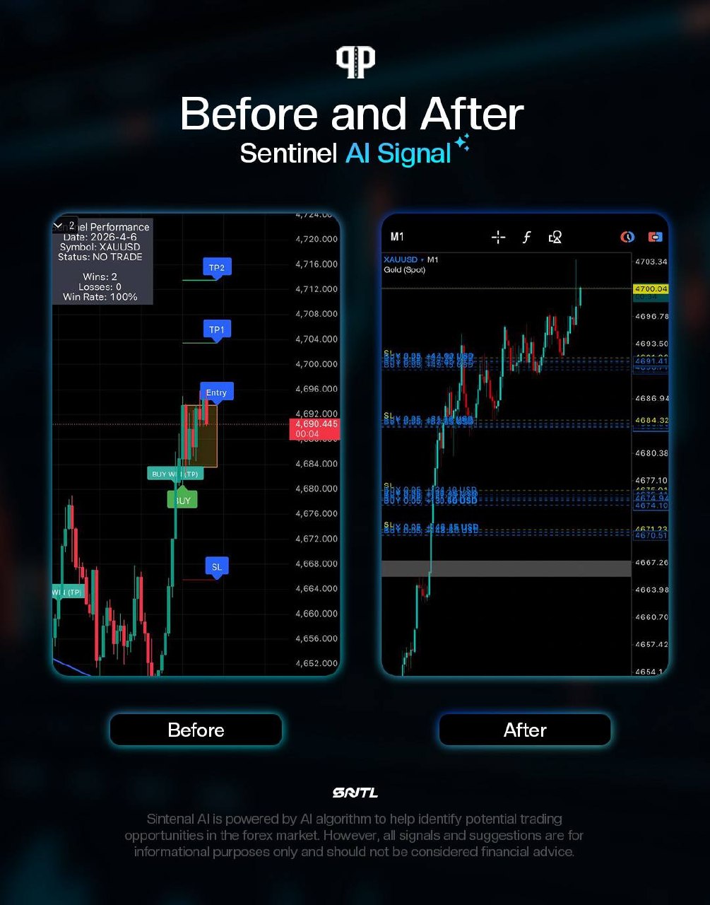 Sentinel AI Before/After 6